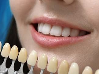 https://prod.tepe.com/globalassets/germany/tepe-share-dach/tepe-share-teeth-whitening.jpg